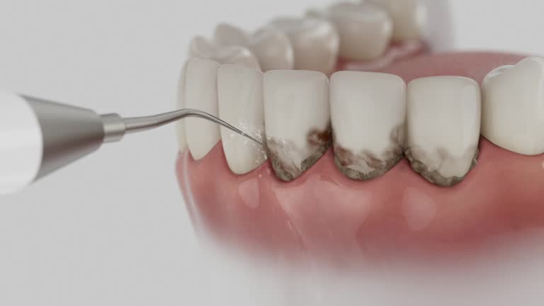 Trusted Root Canal Treatment service in Coral Hills, MD - Dentist Open Now